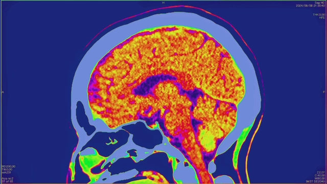 Contrast MRI Brain Scan. 